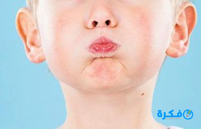 ما هو سبب الزغطة وعلاجها للأطفال 3 medium 2019 01 01 bb2d182e19