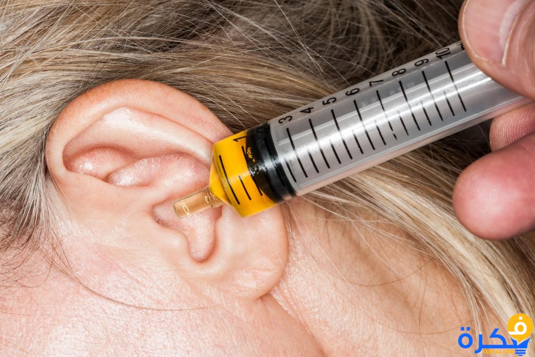 كيف يمكن علاج انسداد قناة استاكيوس ؟ 10 ear drops of oil in syringe being dispensed into clogged ear