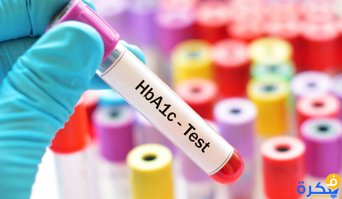 تحليل السكر التراكمي