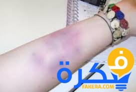 تفسير حلم رؤية الأذى في المنام 5 رؤية الأذى فى المنام