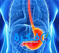 علاج التهابات المعده