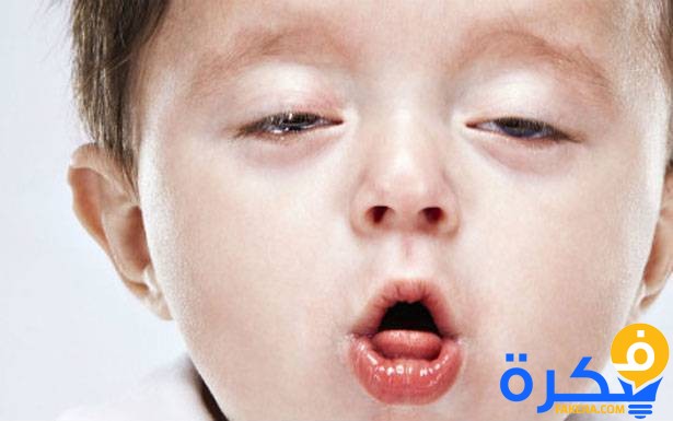 علاج مرض السعال الديكي 7 al so3al aldeke 904270 large