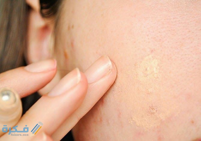 04526470d0557e27f33110fc67bfda16