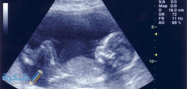 طريقه مضمونه لمعرفه نوع الجنين بدون سونار