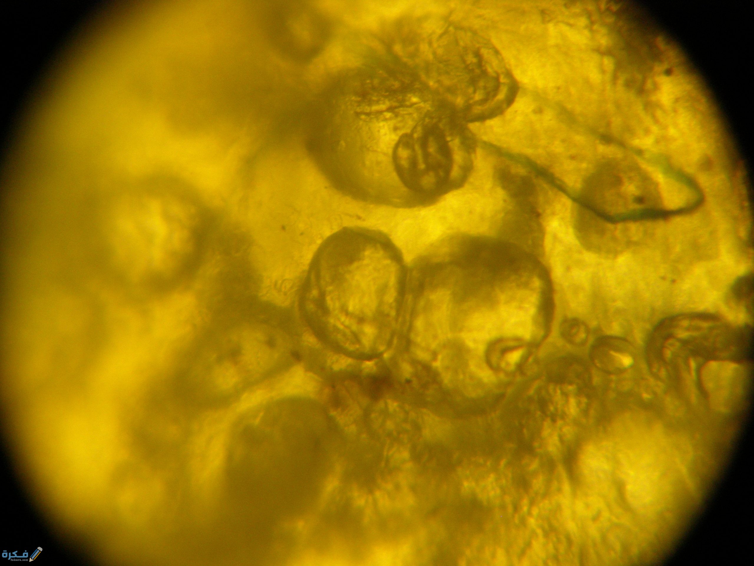 هل البلغم يفطر في نهار رمضان scaled