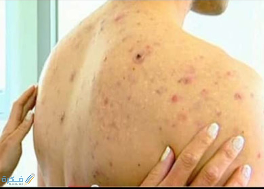 IMG ٢٠٢٠٠٥١٥ ١٧٤٥٤٢