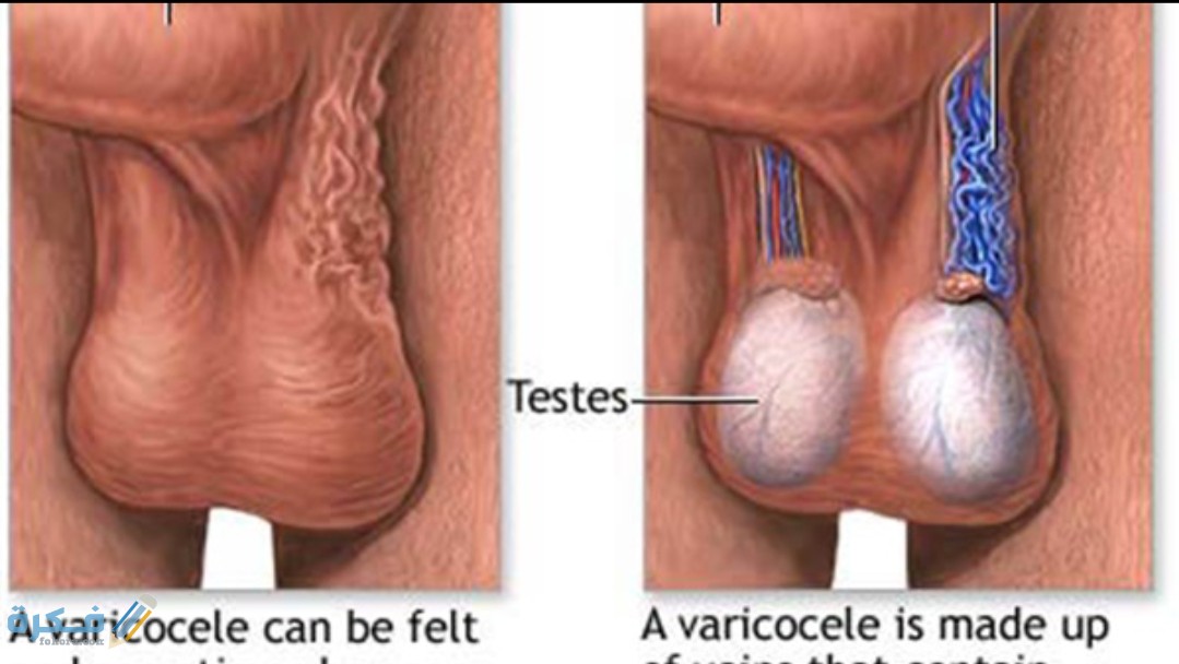 IMG ٢٠٢٠٠٥٢٠ ١٠١١٠٩