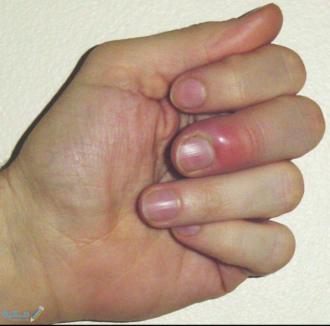 IMG ٢٠٢٠٠٥٢٢ ١٥٥٥٢٥