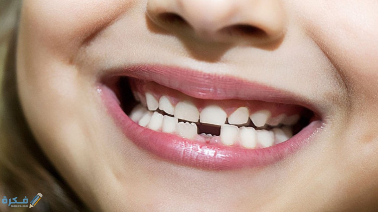 تفسير حلم رؤية سقوط الاسنان