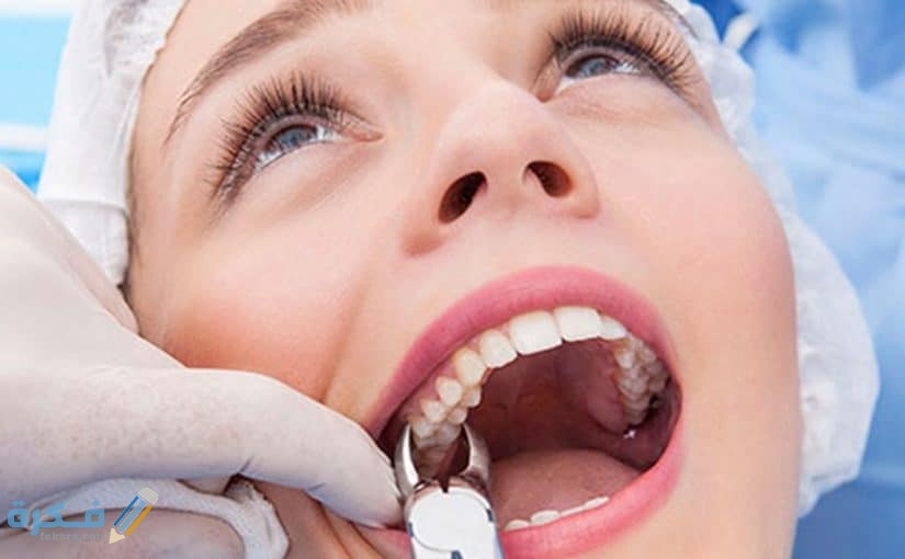 قلع الأسنان في المنام 825x510 1