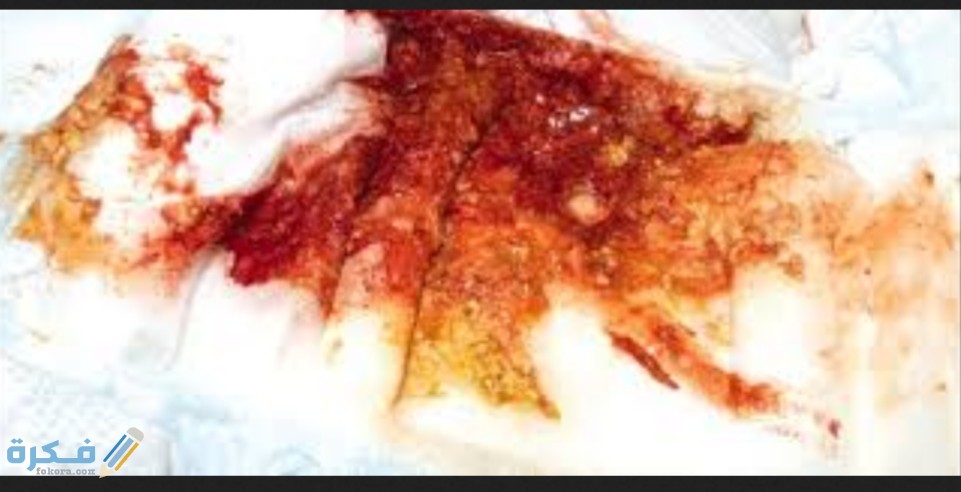 IMG ٢٠٢٠٠٨٠٣ ١٠٣٢٣٠