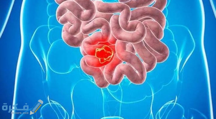 IMG ٢٠٢٠٠٨١٤ ٠٢٥٥١٧