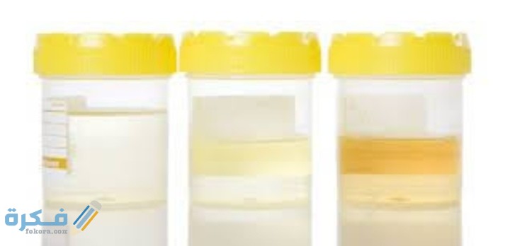 IMG ٢٠٢٠٠٨٢٢ ٠١٤٨٢٢