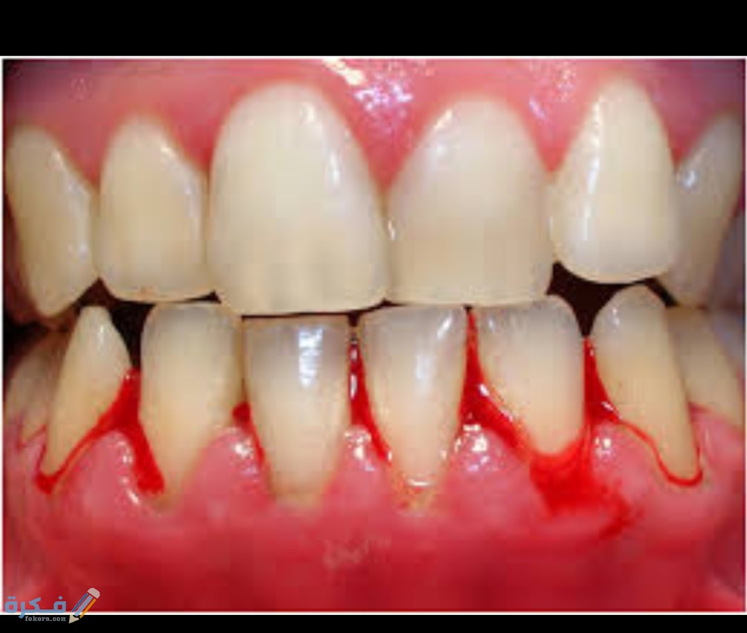 IMG ٢٠٢٠٠٨٢٨ ١٧٥٨٤١