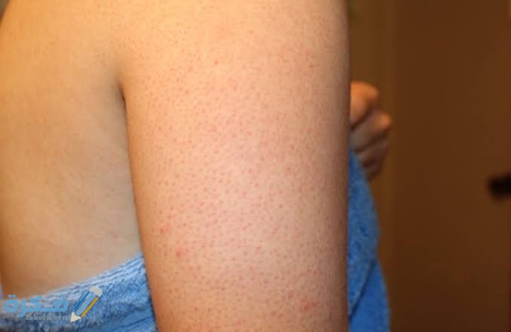 IMG ٢٠٢٠٠٩٠٦ ٢٠١٠٠٣