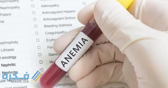 اسماء افضل دواء لعلاج فقر الدم الأنيميا 2026 11 أفضل دواء لعلاج فقر الدم الأنيميا