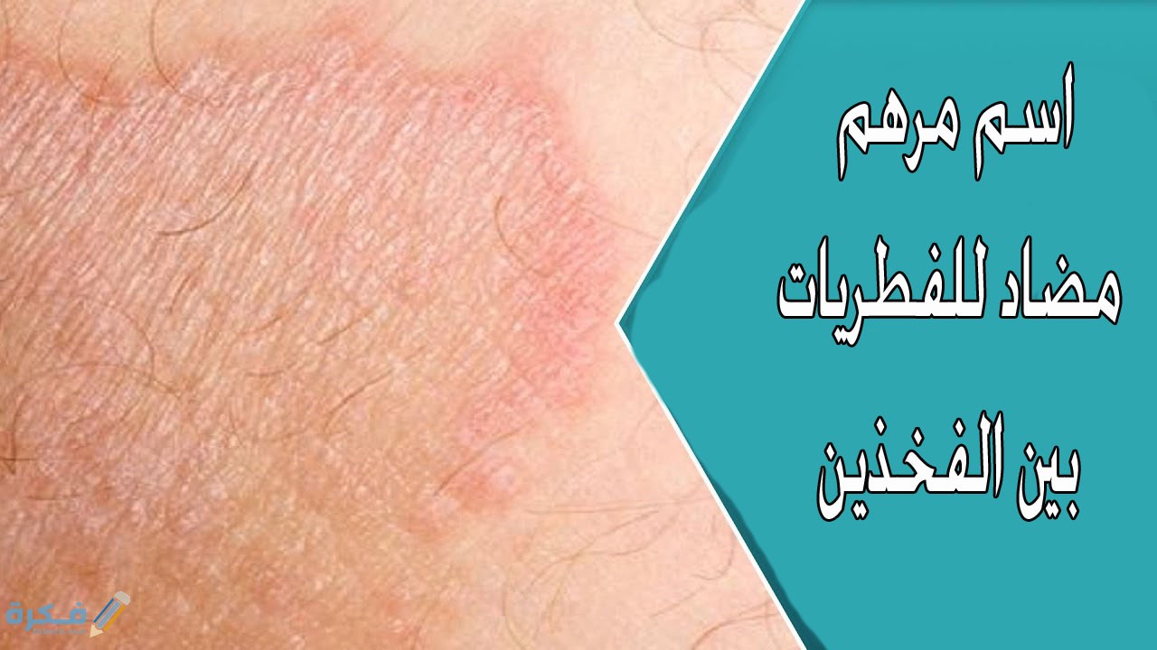 افضل اسماء مرهم مضاد للفطريات بين الفخذين 3 كريم بيتاديرم والتسلخات