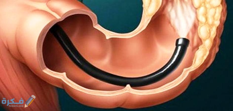 تجربتي مع غسيل القولون وأنواع غسيل القولون ووظائفه 4 الغسيل بالري والاعشاب