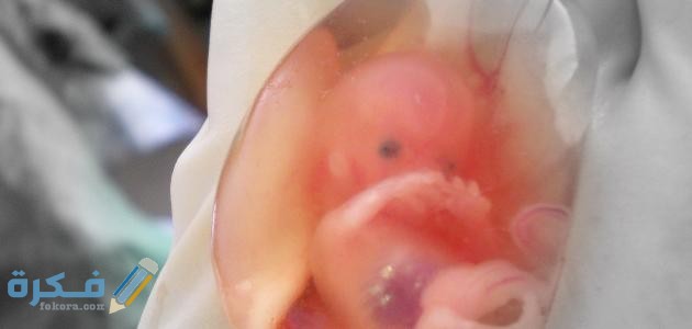 ما هو حكم اجهاض الجنين