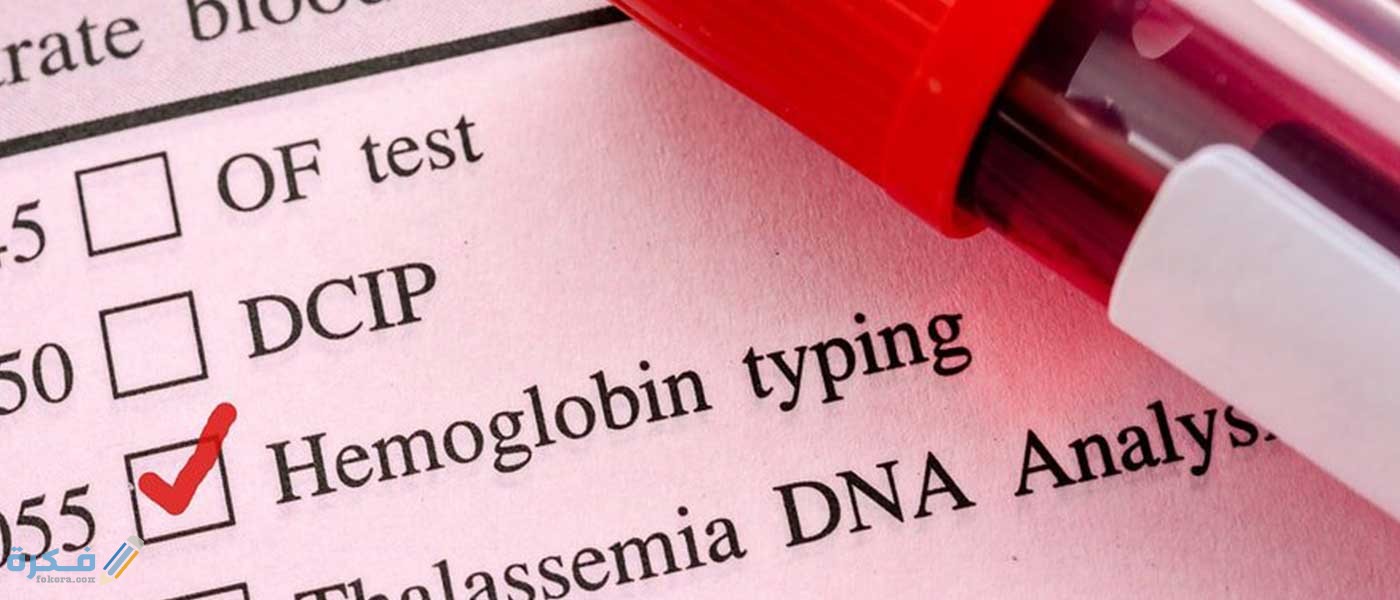 شرح خطوات قياس أو حساب نسبة الهيموجلوبين بالدم بالخطوات ونسبته الطبيعية 7 النسب الطبيعية لهيموجلوبين الدم