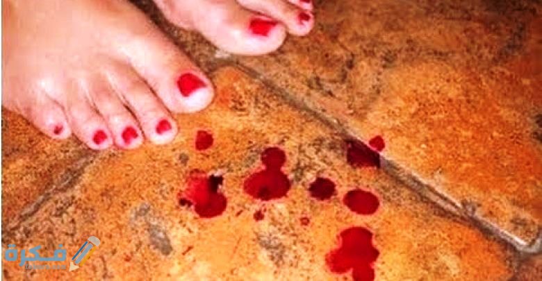 طرق علاج النزيف الحاد