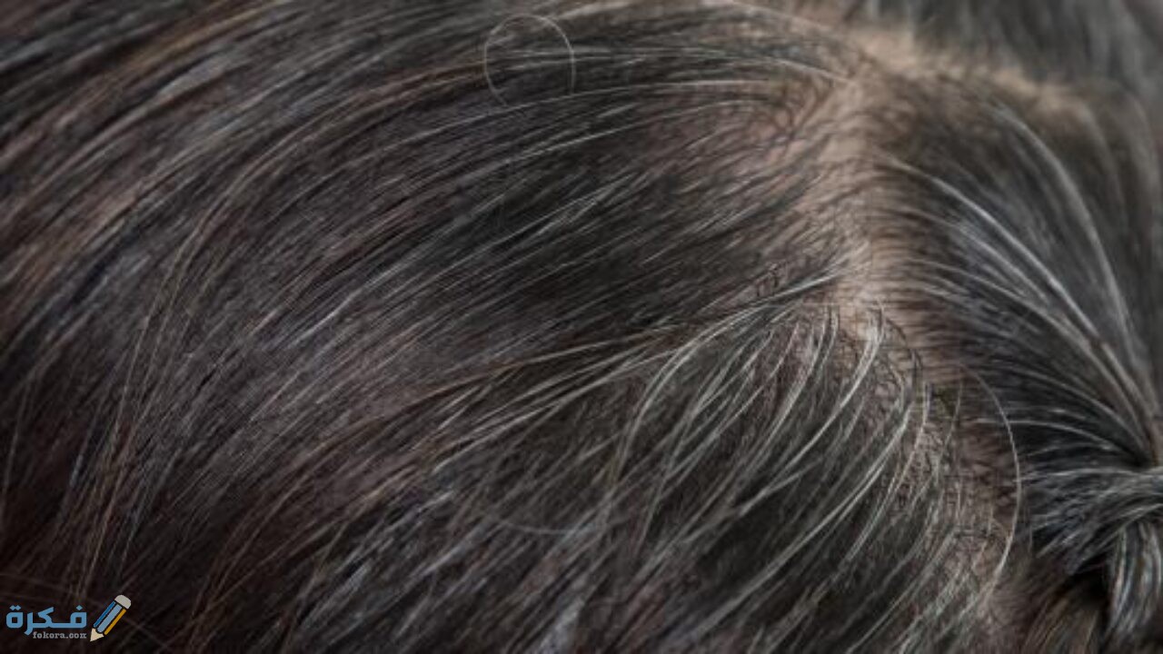 علاج ضعف بصيلات الشعر