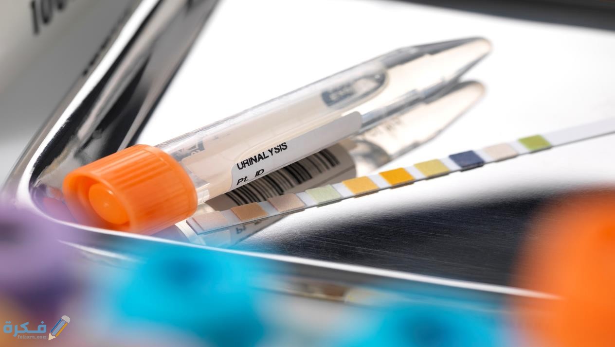 معنى crystals في تحليل البول