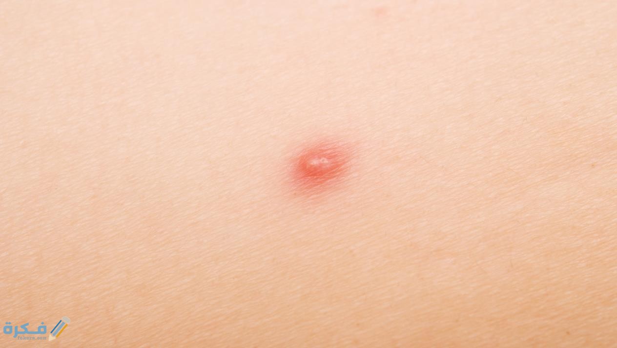 حبوب تحت الابطين