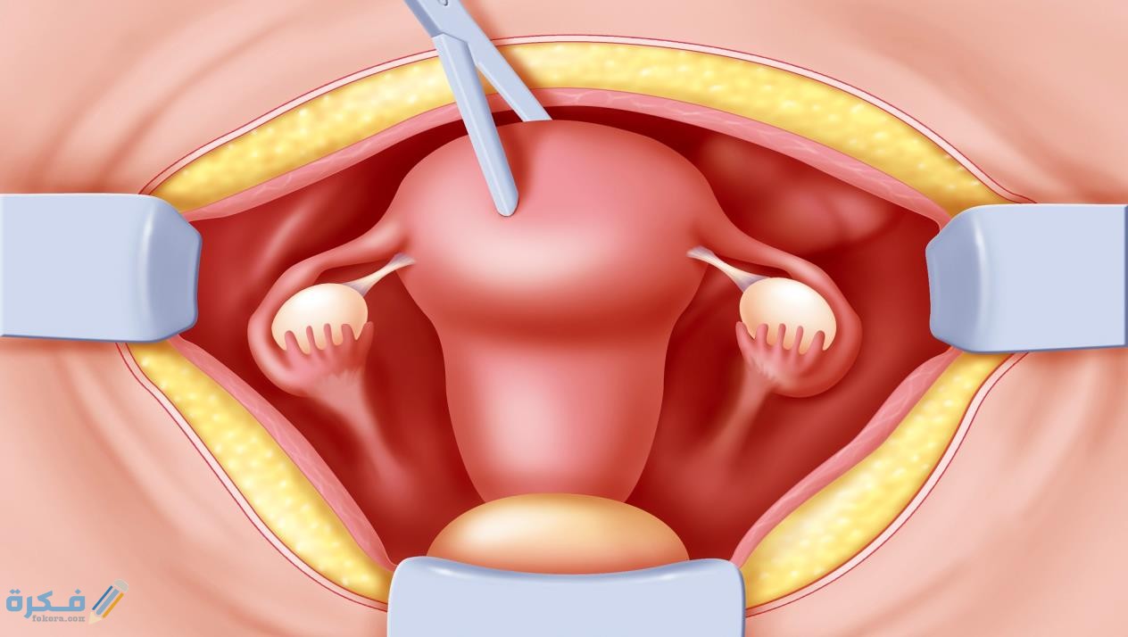 اسم حبوب تنظيف الرحم