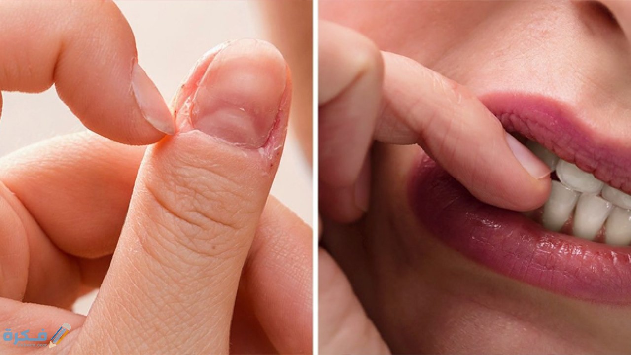 شرح خطوات التخلص من عادة قضم الاظافر بشكل سريع 5 اضرار عادة قضم الاظافر