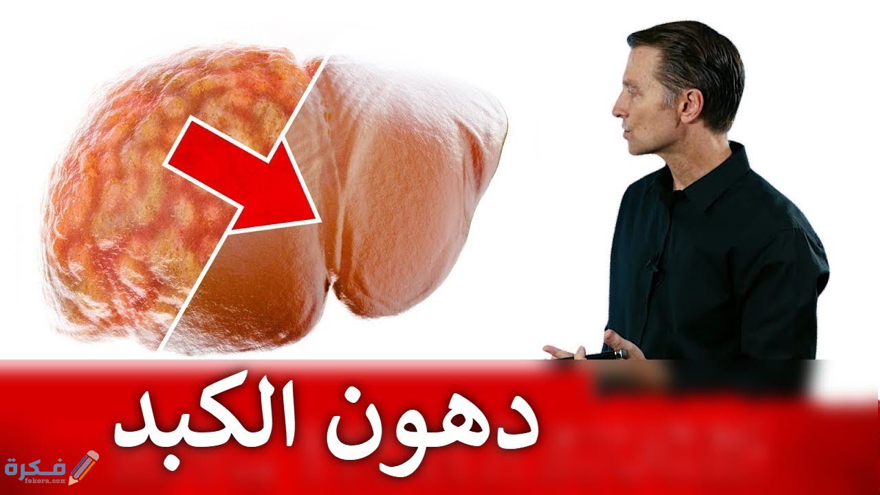 شرح خطوات التخلص من دهون الكبد وأضرارها الصحية 5 اسباب الاصابة بدهون الكبد