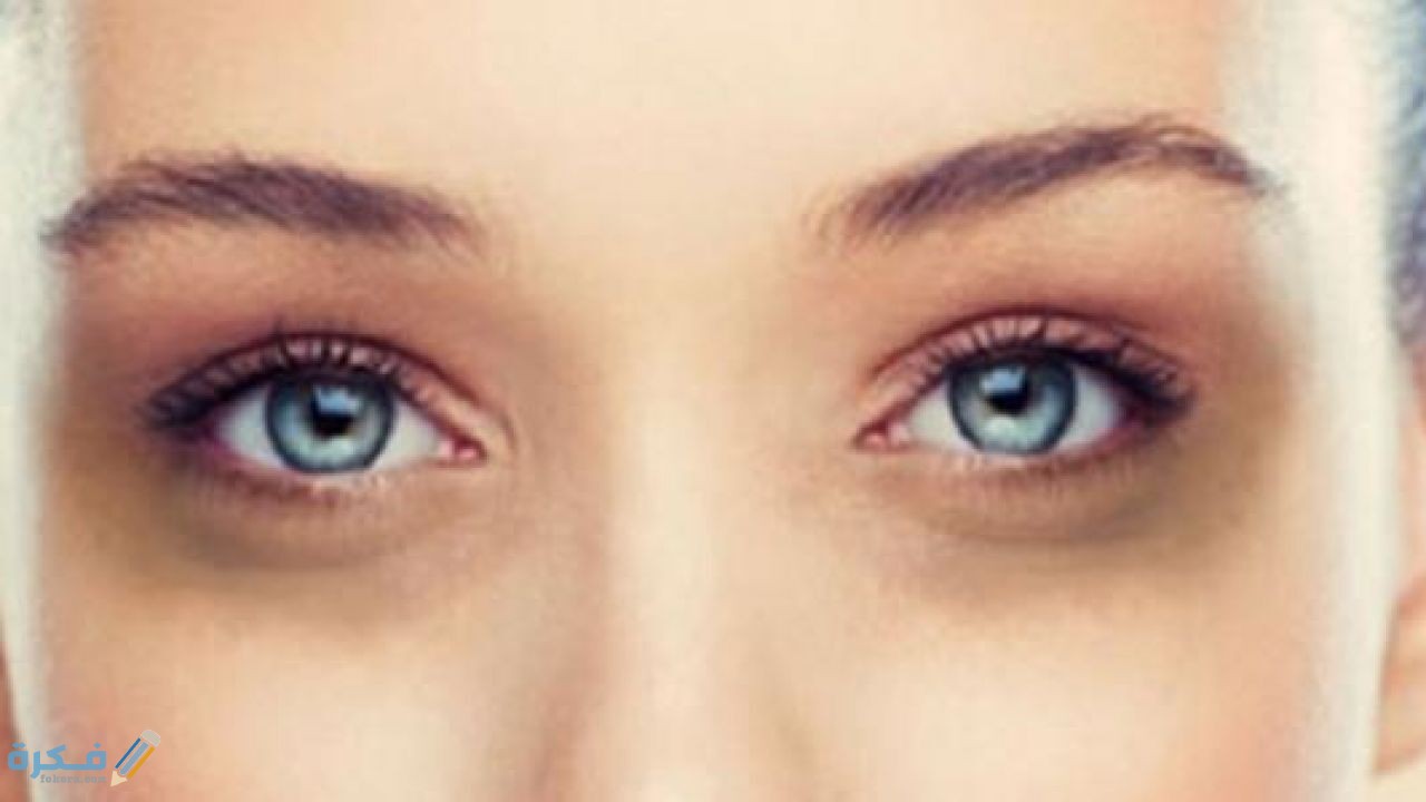 طريقة التخلص من سواد تحت العين