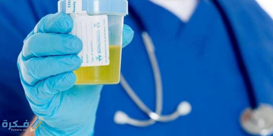 تجربتي مع زلال البول اسبابه وطرق العلاج 4 مفهوم زلال البول