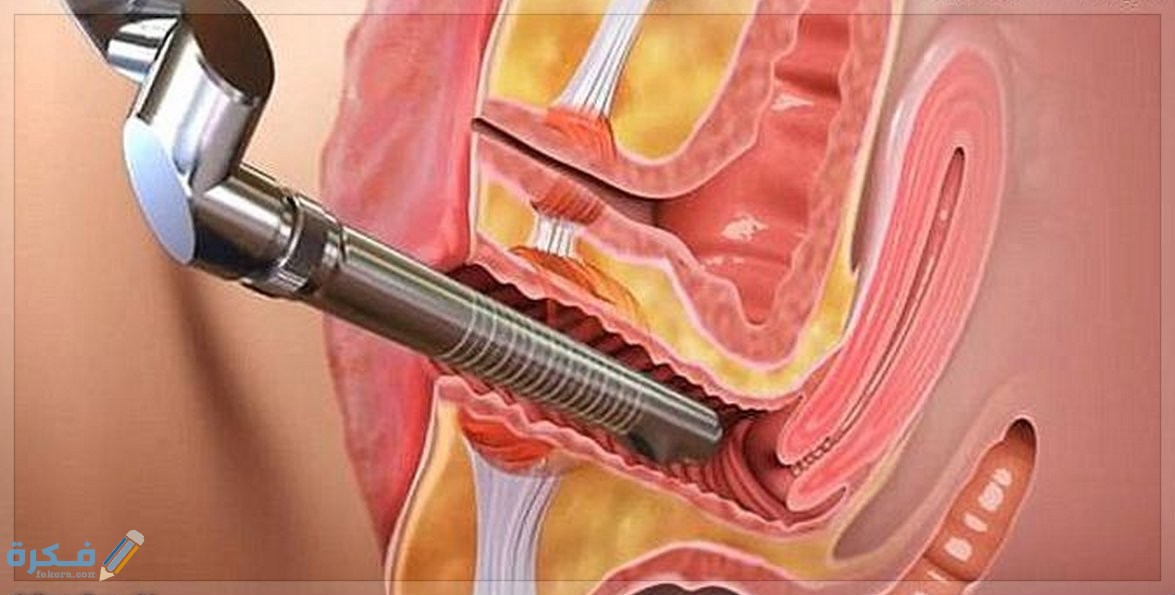 BF713B75 40B7 4CE9 B4EE E561EE97E4C0