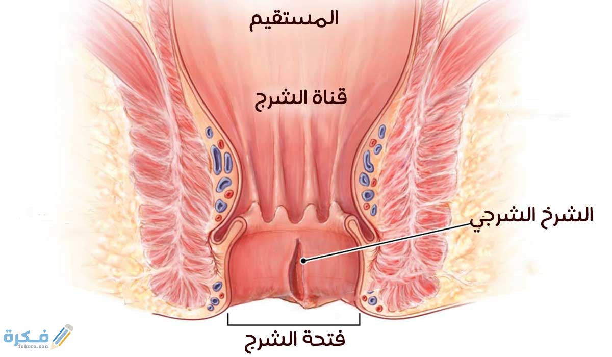 علاج شرخ المستقيم بالاعشاب