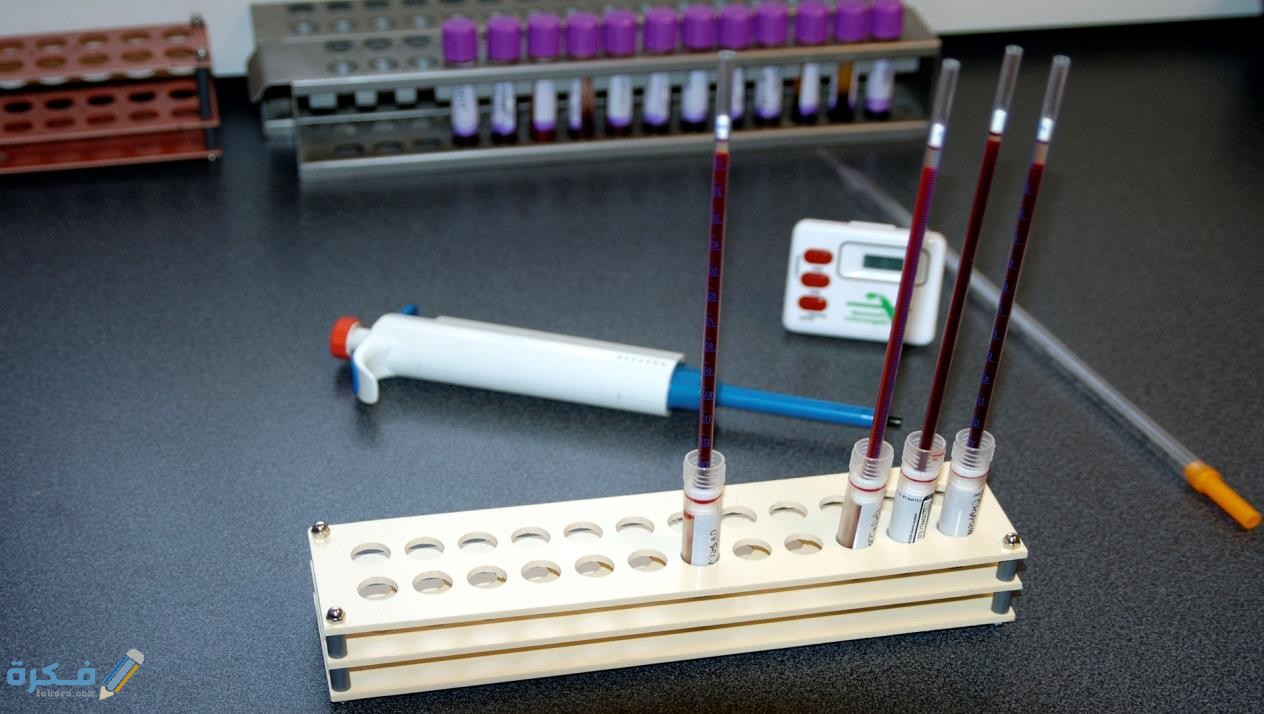 ماذا يظهر انخفاض سرعة الترسيب؟