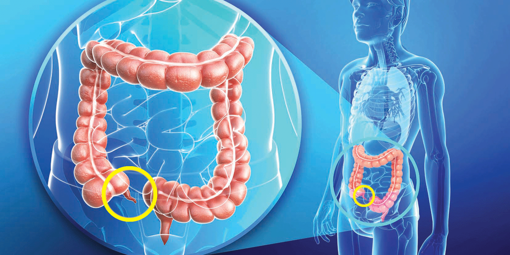 أين تقع الزائدة الدودية