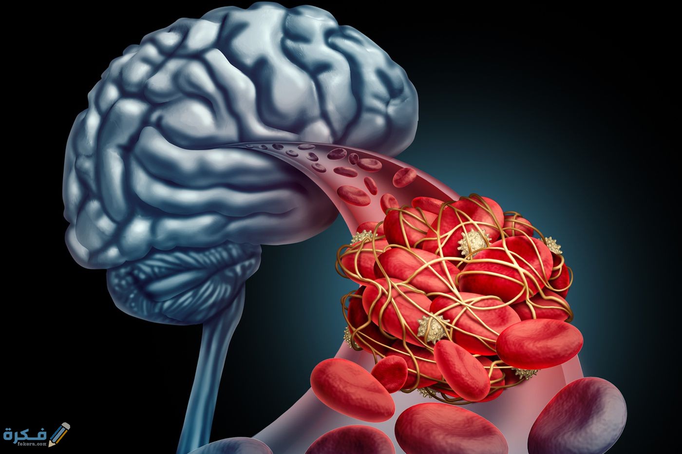 أعراض الجلطة الدماغية