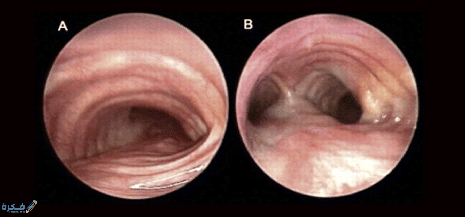 ما أهمية الغضاريف في الجسم