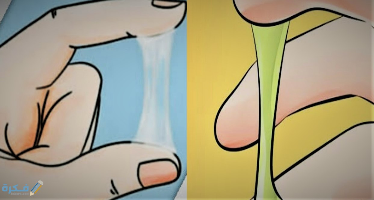 الافرازات المهبلية التي تصيب المرأة