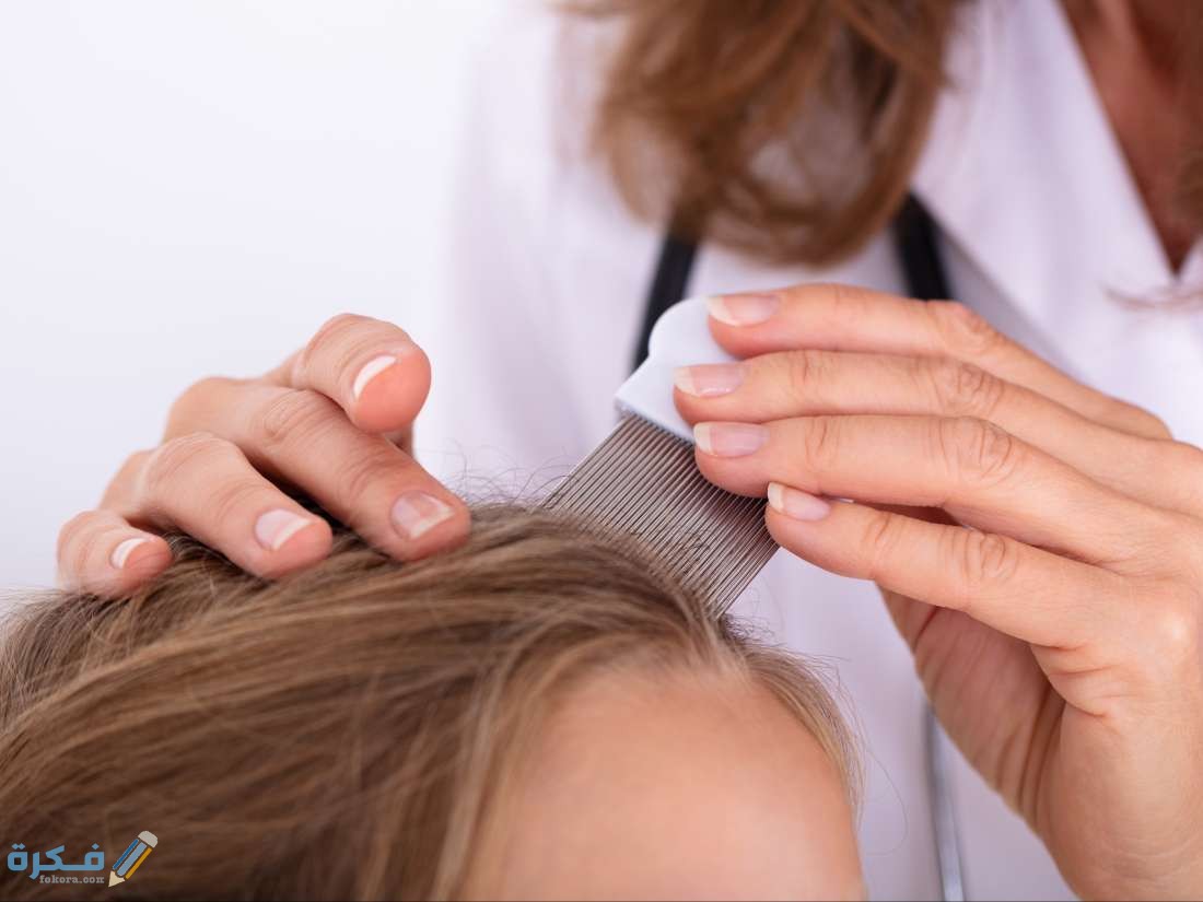 طريقة إزالة القمل من شعر الأطفال