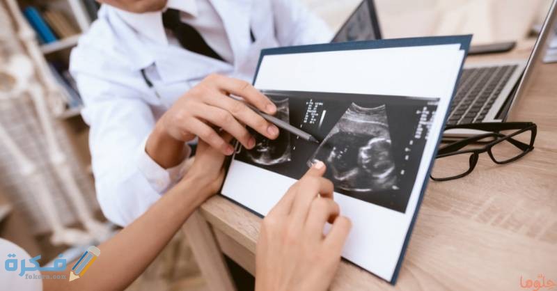 F22A5791 4D75 4594 B84D 32302CF7F8B5