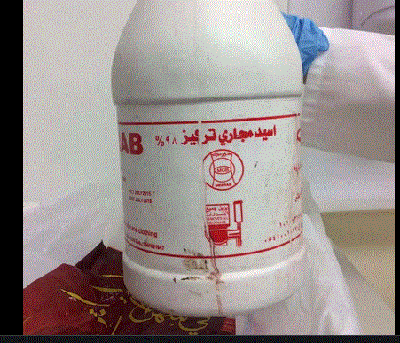 طريقة تسليك المجاري بالاسيد