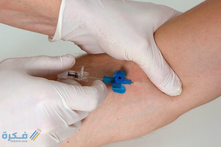 اماكن تركيب الكانيولا للمريض