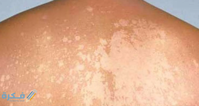 8B9545E5 67C2 42FC BD4A 698F81631AB9