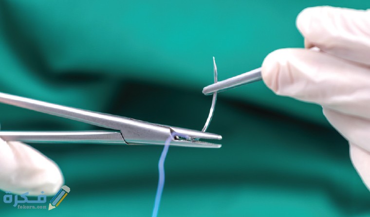 AJGP 09 2019 Focus Turner Surgical Management Acute Lacerations Feature