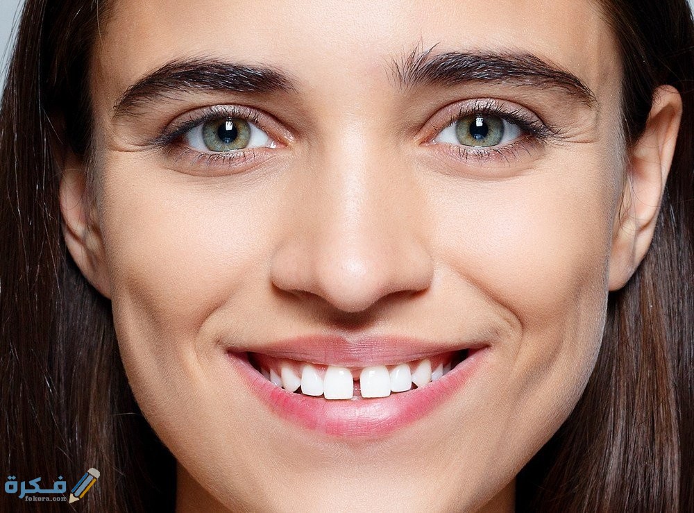 تفسير حلم الأسنان الأمامية متفرقة