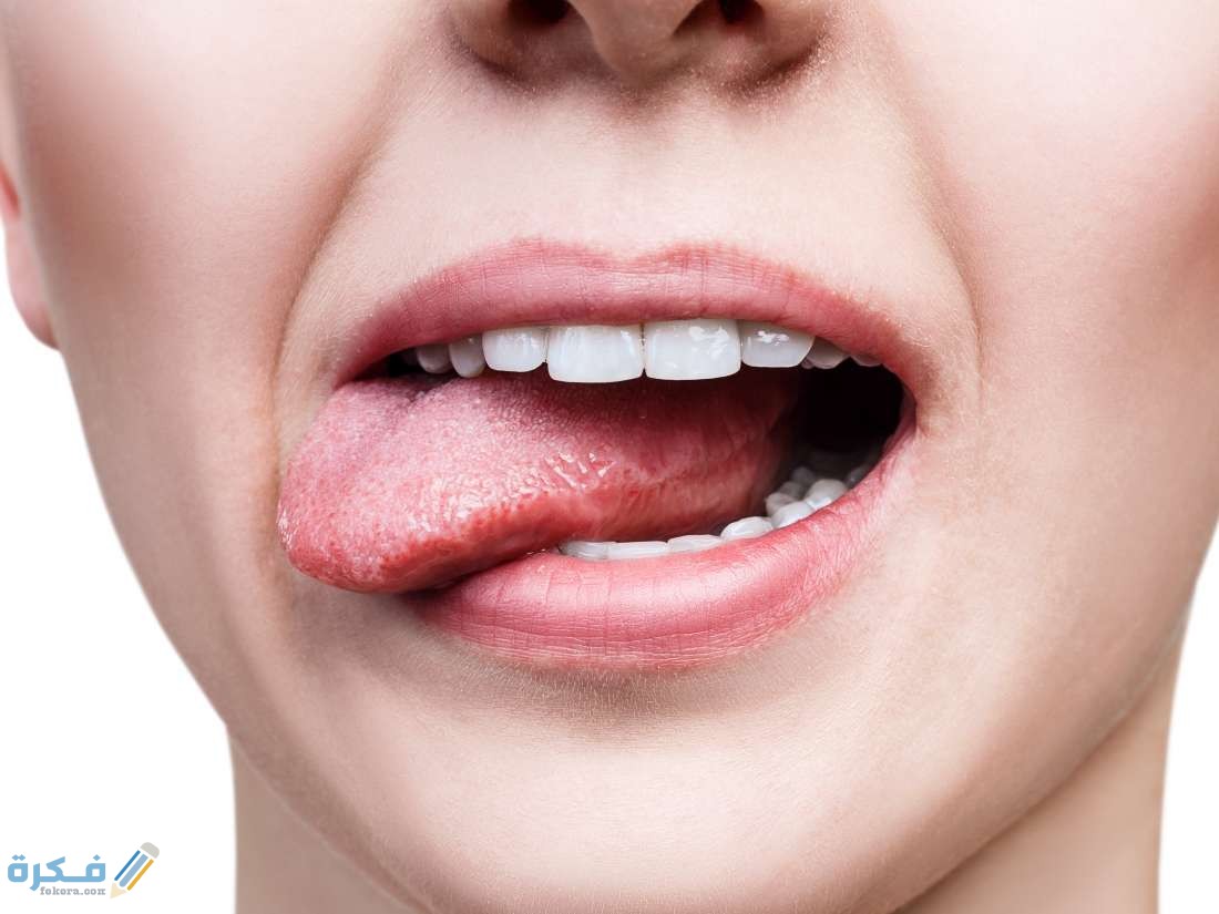 54286 مرارة الفم 2