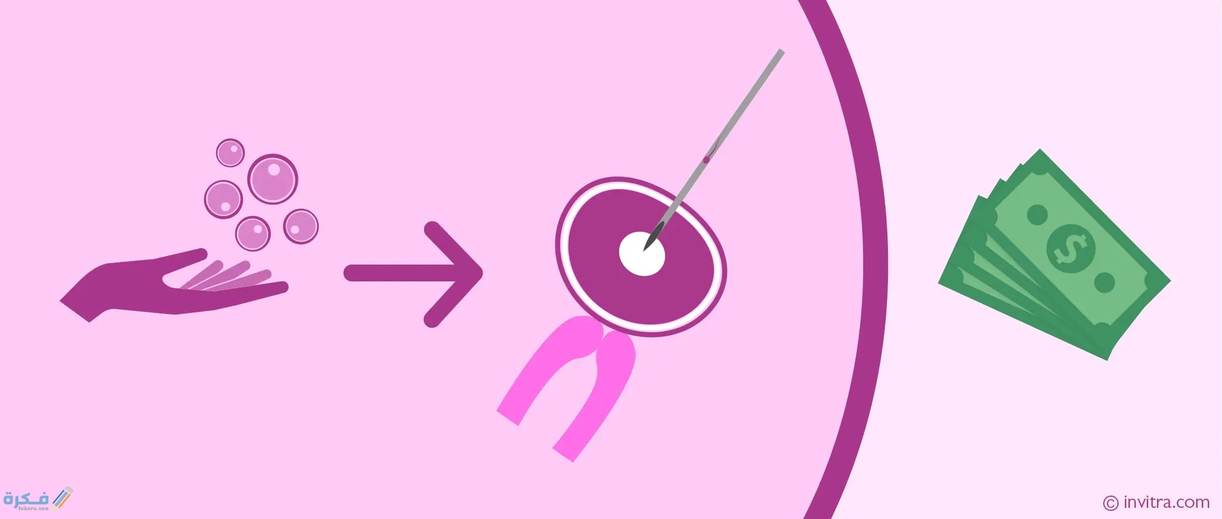 خطوات عملية الحقن المجهرى