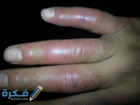 zjePpLkZIWAYoe3KhROtvgHaFj